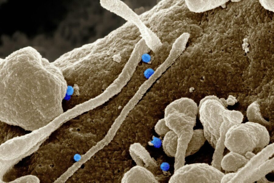 Mokslininkų sprendimas dykumoms: laboratorijose išaugintos bakterijos sumažina dirvožemio nuostolius