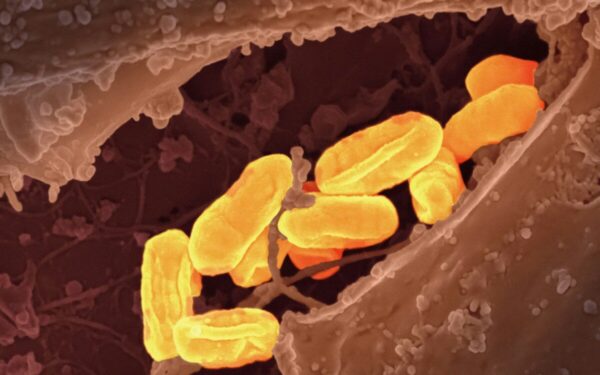 Antibiotikų era braška: sužinokite, kodėl šiltinė vėl atsidūrė mokslininkų akiratyje