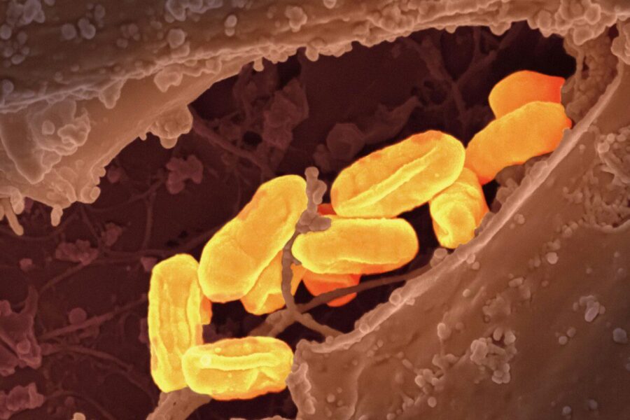 Antibiotikų era braška: sužinokite, kodėl šiltinė vėl atsidūrė mokslininkų akiratyje