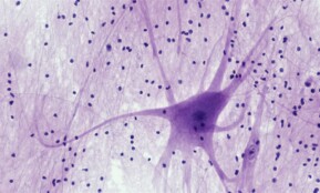 Nervous Tissue: Spinal Cord Motor Neuron