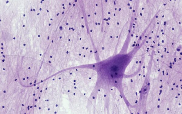 Atrastas būdas atjauninti smegenis: mokslininkai sugalvojo, kaip vėl priversti ląsteles augti