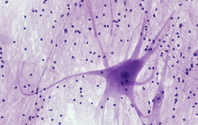 Nervous Tissue: Spinal Cord Motor Neuron