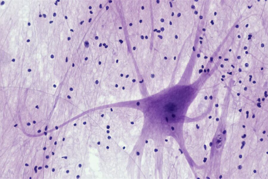 Nervous Tissue: Spinal Cord Motor Neuron