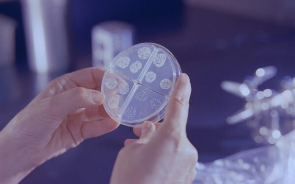 Naujas žingsnis neurologijoje: smegenų organoidai mokosi ir jau sprendžia inžinerines problemas