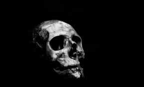 a black and white photo of a human skull