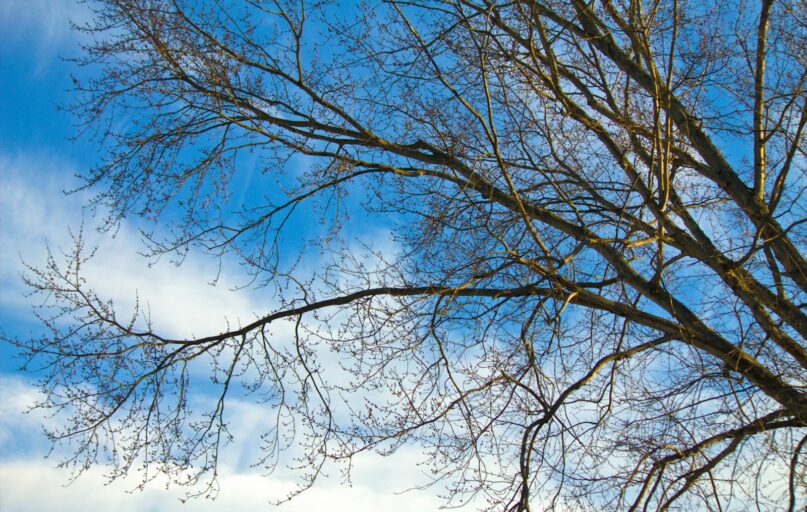 Bare tree branches against a bright blue sky