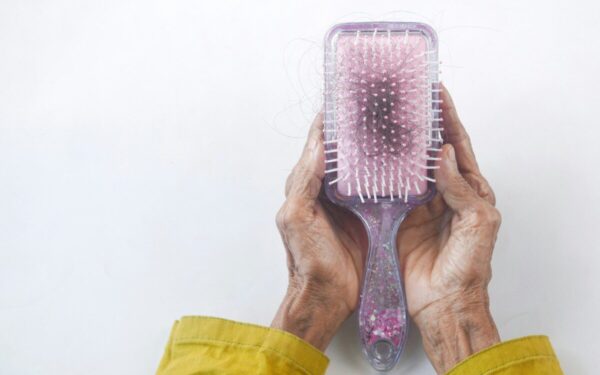 Plaukų slinkimas duše: kaip suprasti, ar tai natūralu, ar rimtas sveikatos signalas?