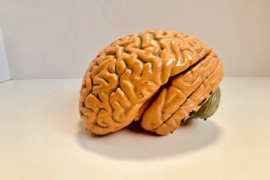 Neįtikėtina hipotezė: vėžys gali stabdyti Alzheimerio ligą, teigia nauji tyrimai