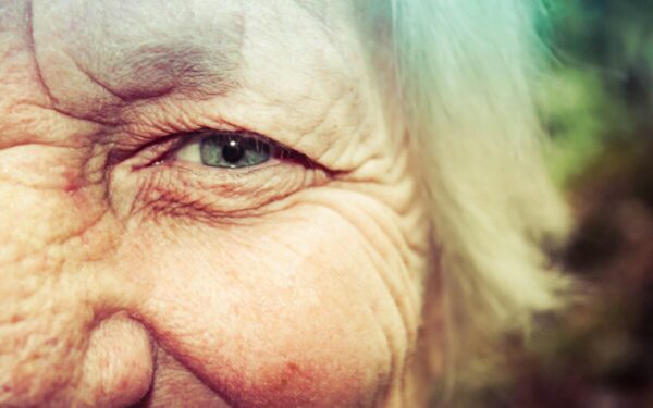 Moterys šluoja šią pigią priemonę: poveikis raukšlelėms aplink akis stebina net skeptikes