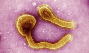 a close up of an animal cell with a yellow substance