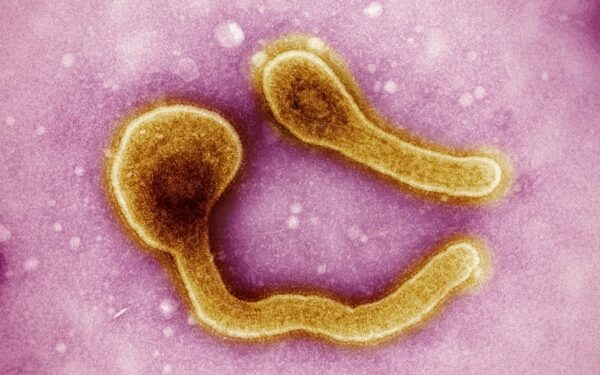 Kas nutinka bakterijoms kosmose? Atsakymas gali pakeisti infekcijų gydymą