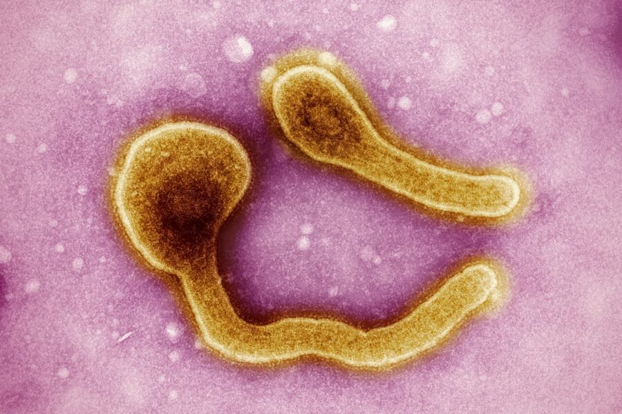 a close up of an animal cell with a yellow substance