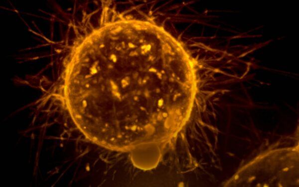 Vėžio diagnostika keičiasi amžiams: šis naujas jutiklis vėžį atpažįsta be jokių cheminių dažų