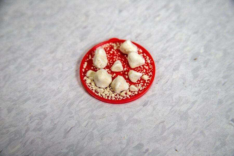 Mityba ir inkstų akmenligė: gydytojų patarimai, kaip sumažinti inkstų akmenų riziką