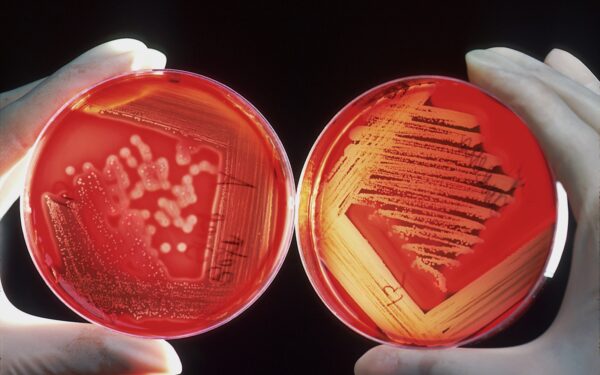 Kraujo vėžys dažnai nustatomas per vėlai: simptomai, kuriuos būtina žinoti kiekvienam