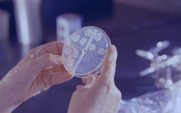 Ukraina pertvarko sveikatos sistemą: nauji tuberkuliozės testai turėtų pagerinti ankstyvą diagnostiką