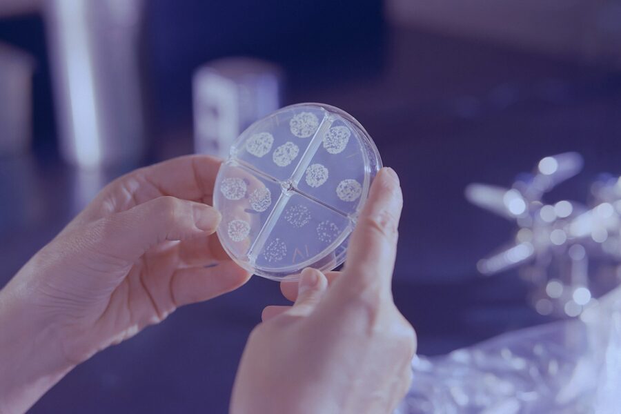 Ukraina pertvarko sveikatos sistemą: nauji tuberkuliozės testai turėtų pagerinti ankstyvą diagnostiką