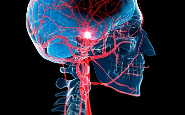 Neurologas perspėja: šie įpročiai gali padidinti kraujavimo į smegenis riziką ir sukelti insultą