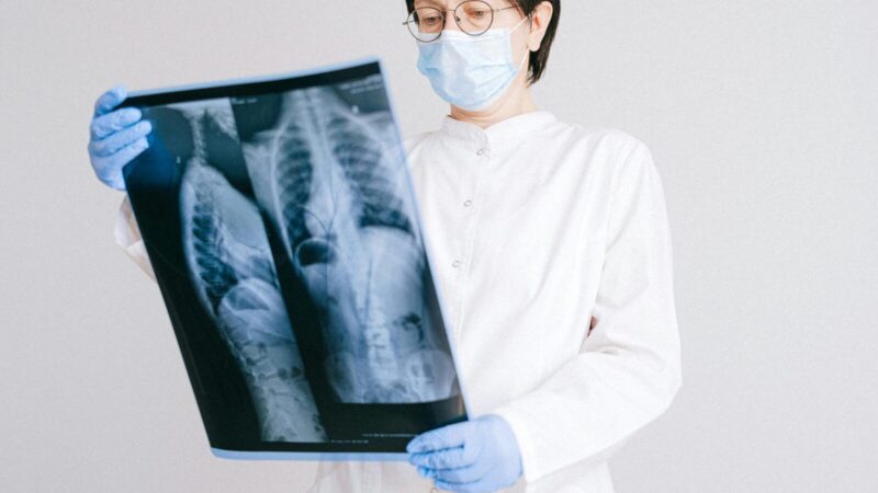 Nuovargis ir diskomfortas gali slėpti rimtą problemą: kepenų fibrozė kartais lieka nepastebėta