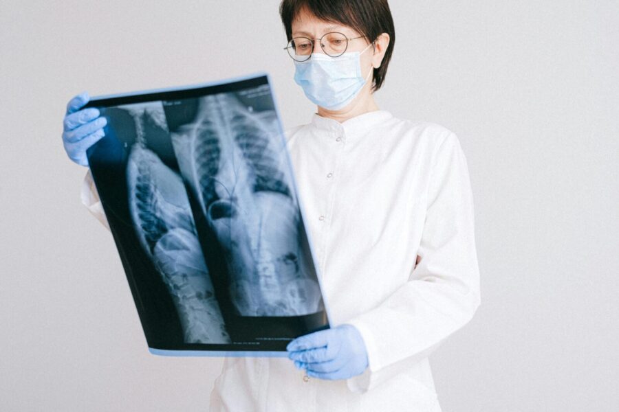 Nuovargis ir diskomfortas gali slėpti rimtą problemą: kepenų fibrozė kartais lieka nepastebėta