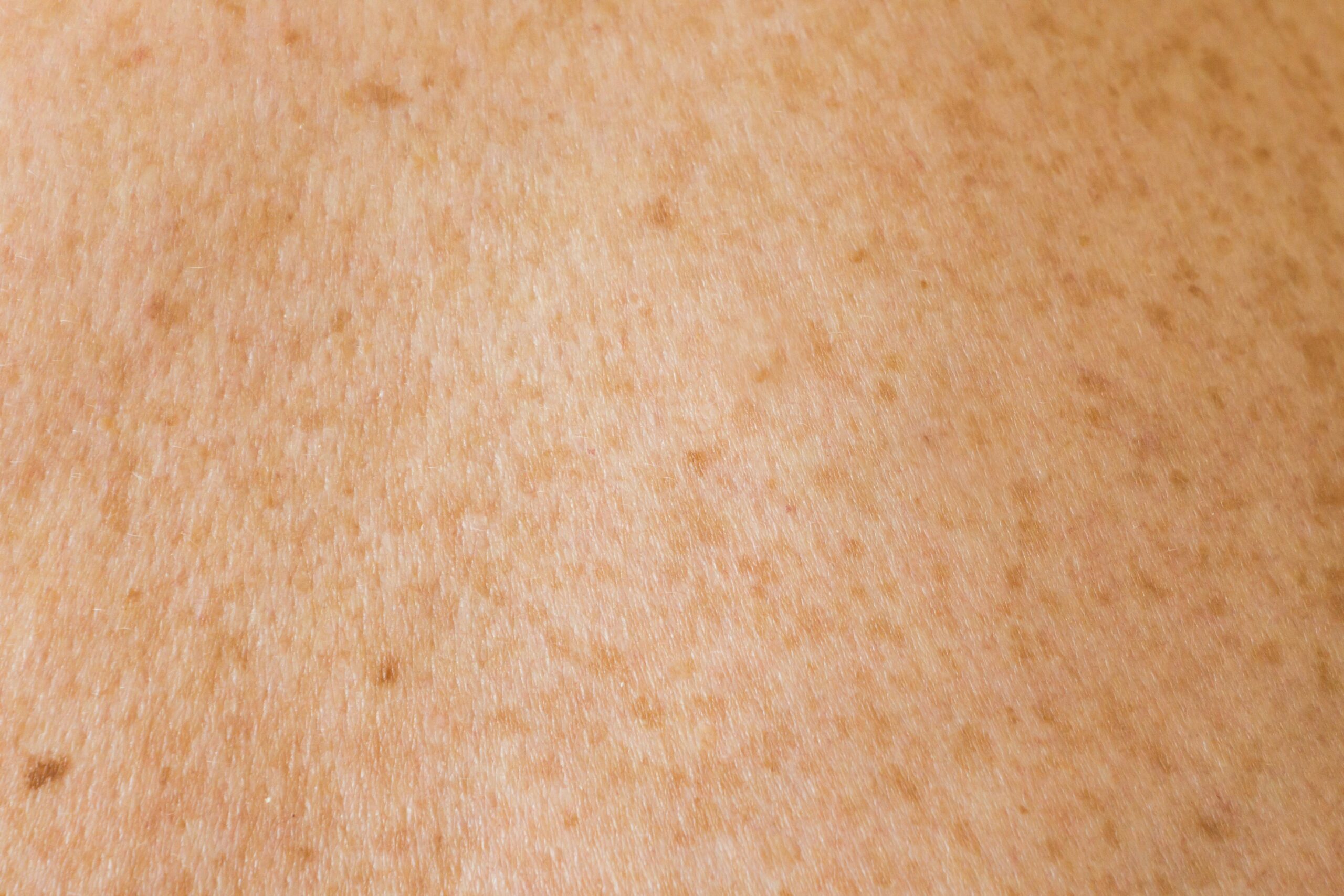 Kurmiai. Unsplash nuotr