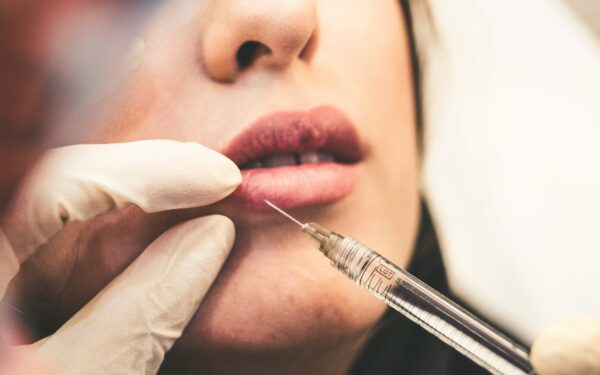 Botoksas gali pakeisti daugiau nei tik raukšles: ką svarbu suprasti prieš procedūrą?