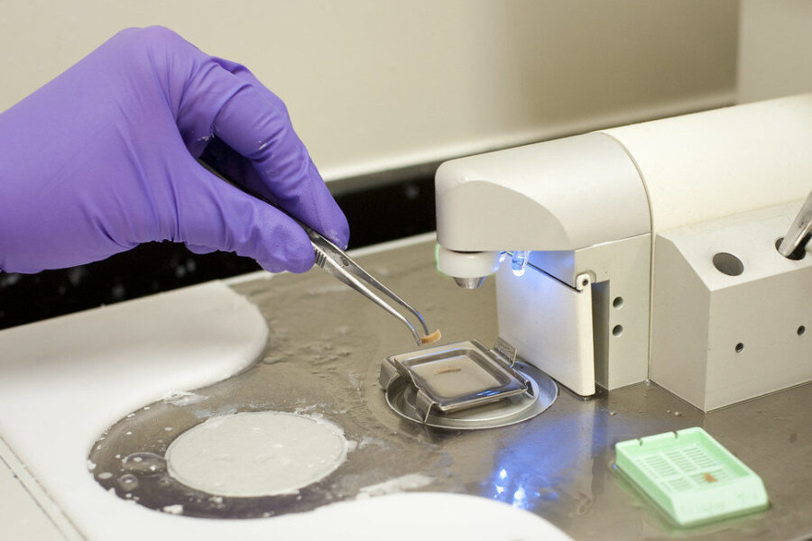 Ne tik alkoholis kenkia kepenims: gydytojai atkreipė dėmesį į kitus svarbius rizikos veiksnius